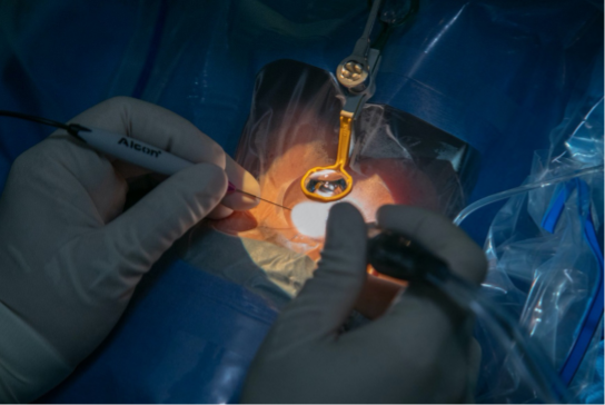 新しい医療設備で、安全な日帰りでの網膜硝子体手術